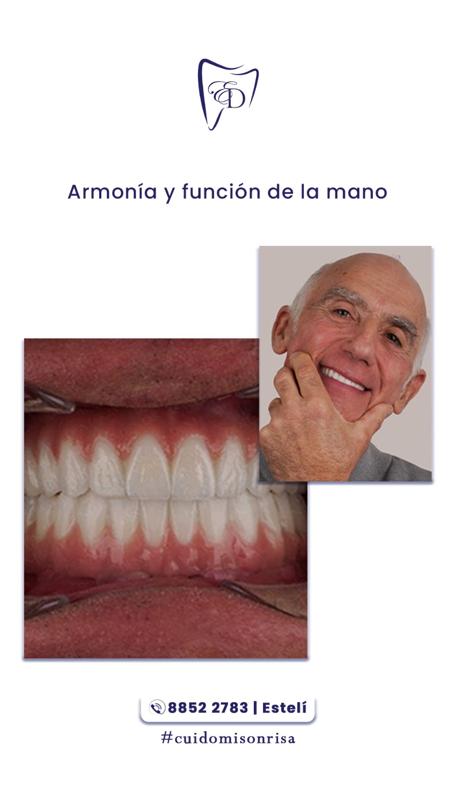 Caso clínico 18